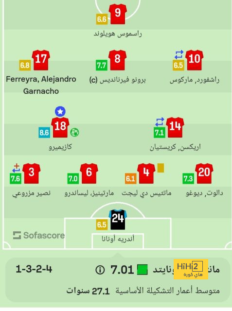 غيابات مانشستر سيتي عن الديربي أمام اليونايتد 